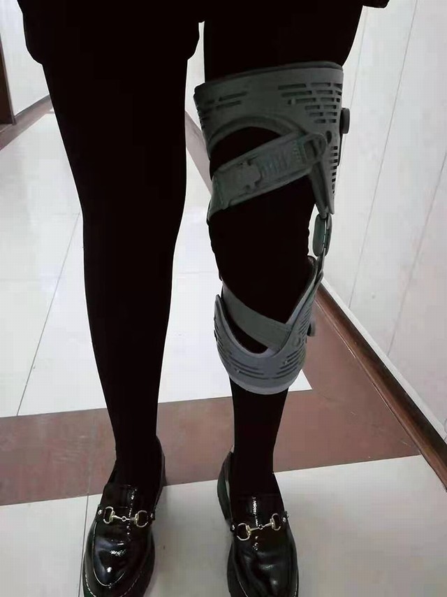 免荷一号（骨性枢纽炎）