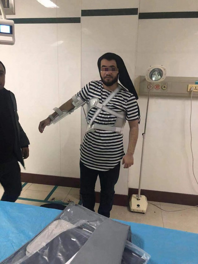 肩枢纽外展架