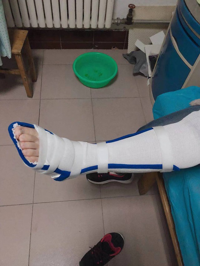 踝足低温
